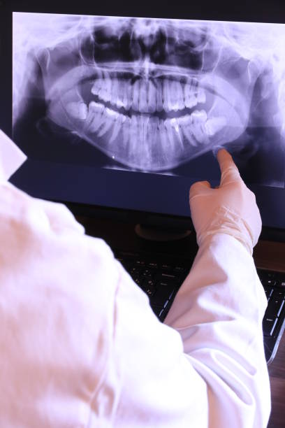 Best Emergency Treatment for Dental Infections or Abscesses in Pembroke Park, FL