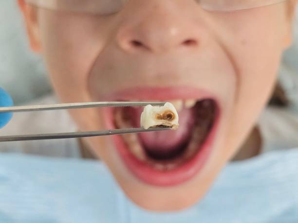 Best Emergency Gum Treatment in Pembroke Park, FL