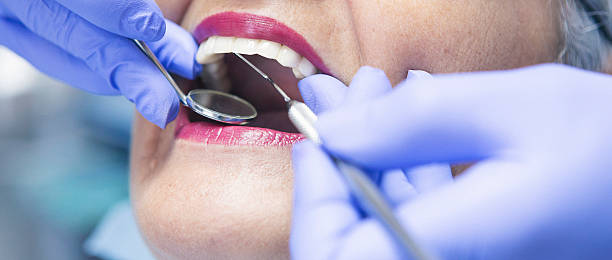 Best Emergency Dental Care for Broken or Chipped Teeth in Pembroke Park, FL